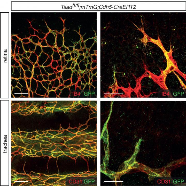 Blood Vessel Growth Differs Between Tissues, Opening Door to Tissue-Specific Therapy (2 of 4)