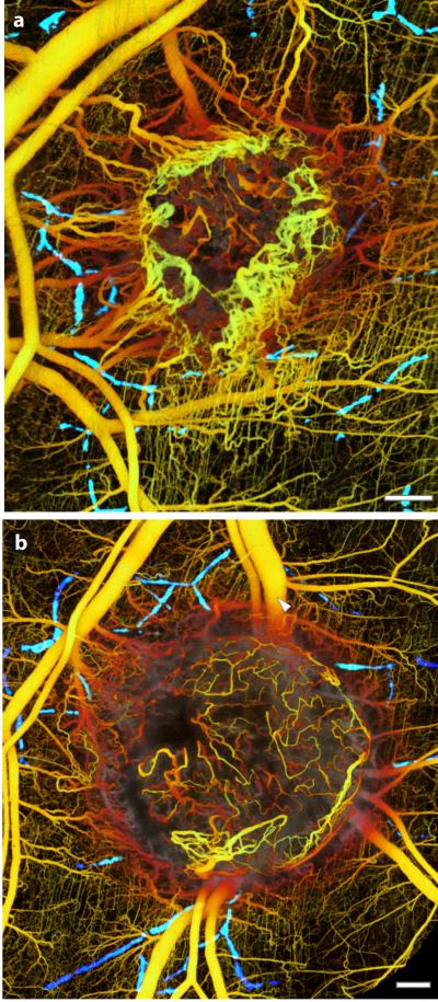Before and After Treatment