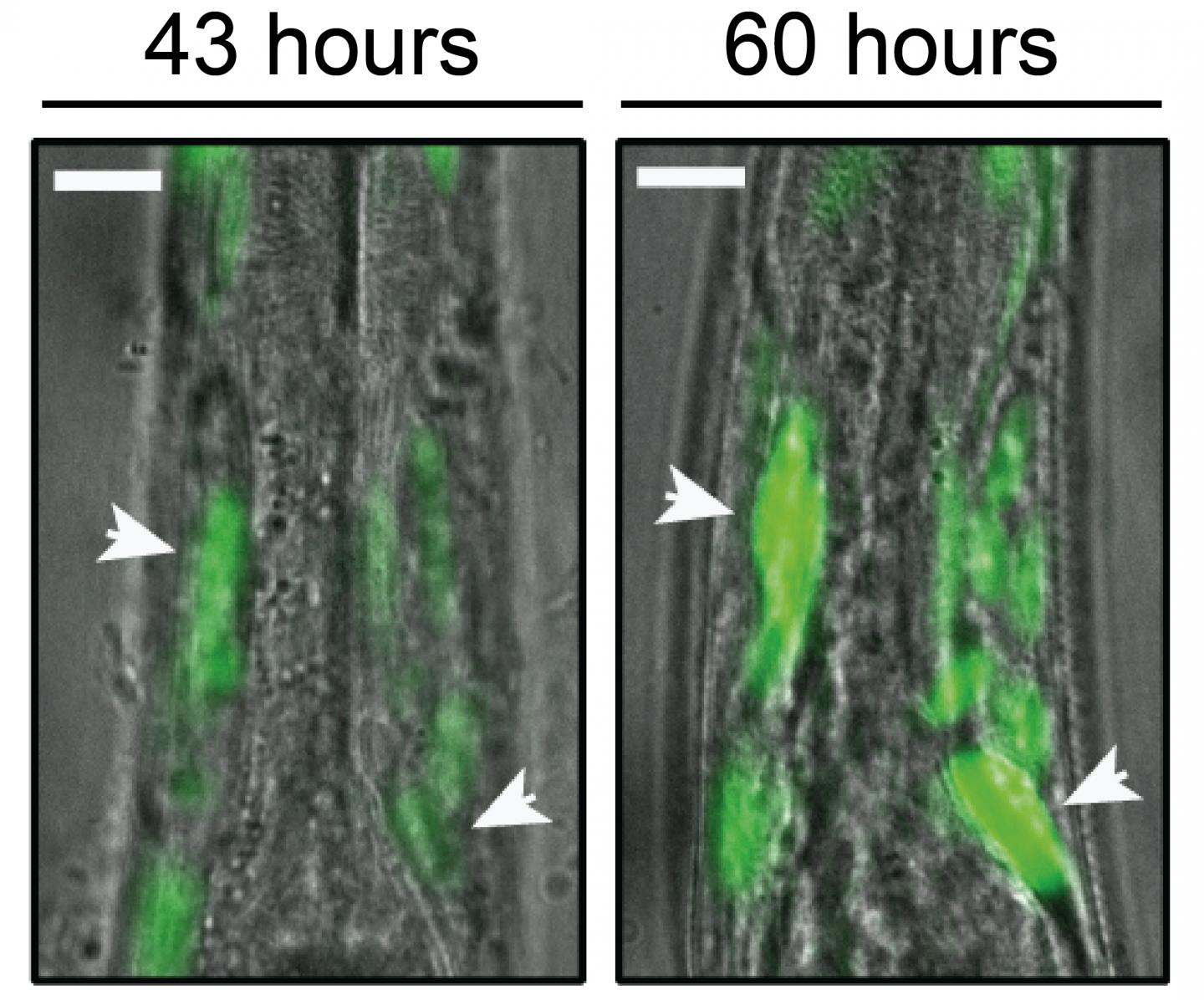 Protein Plaques Evolution in a Worm