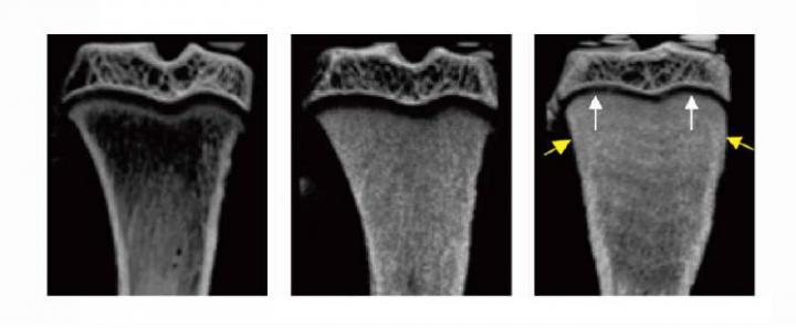 Rat Tibia Micro CT Scan