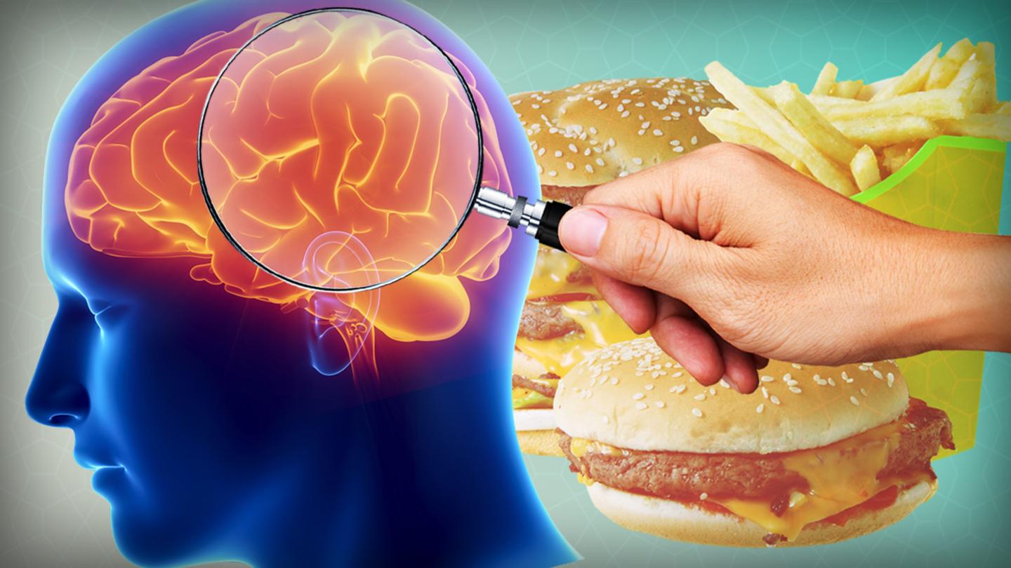 Is Obesity 'All in Your Head'?