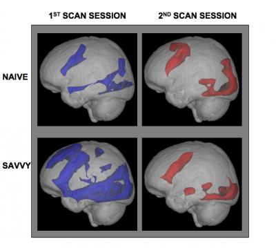 Brain Images from UCLA Internet Study