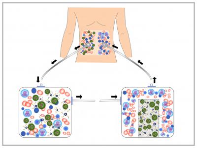 Magnetic Nanoparticle Treatment System