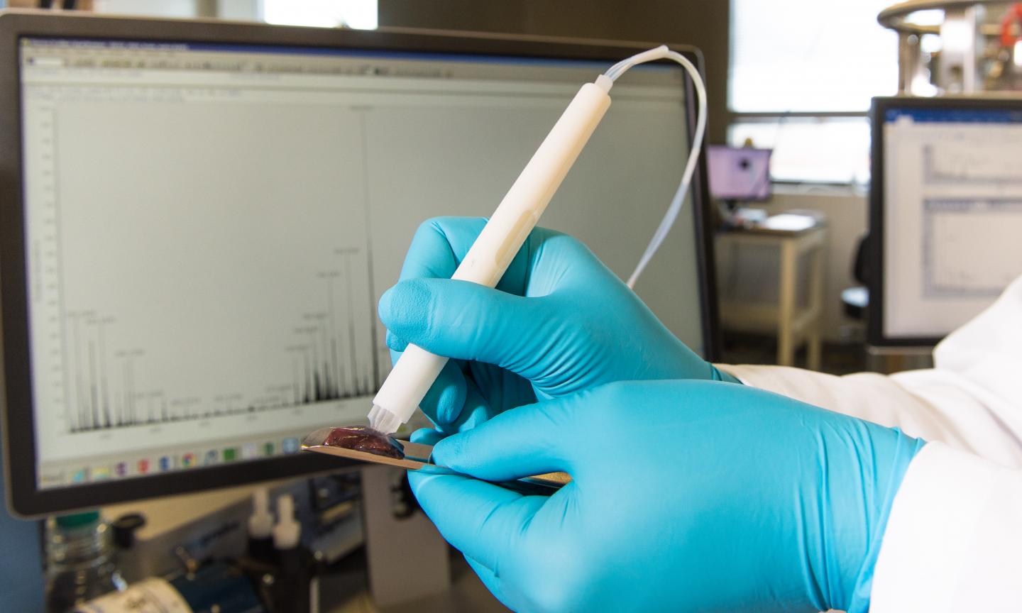 Handheld "Pen" May Bring Real-time Cancer Diagnosis to Surgeons' Fingertips (3 of 11)