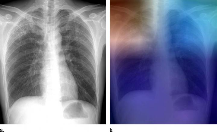 Radiographs