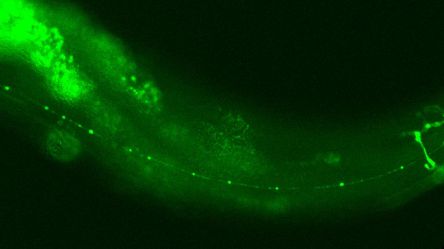 New Protein Discovery in <em>C. elegans</em>