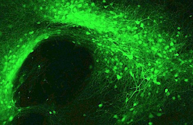 Neurons of the Nucleus Accumbens, a Critical Brain Region Involved in Addiction