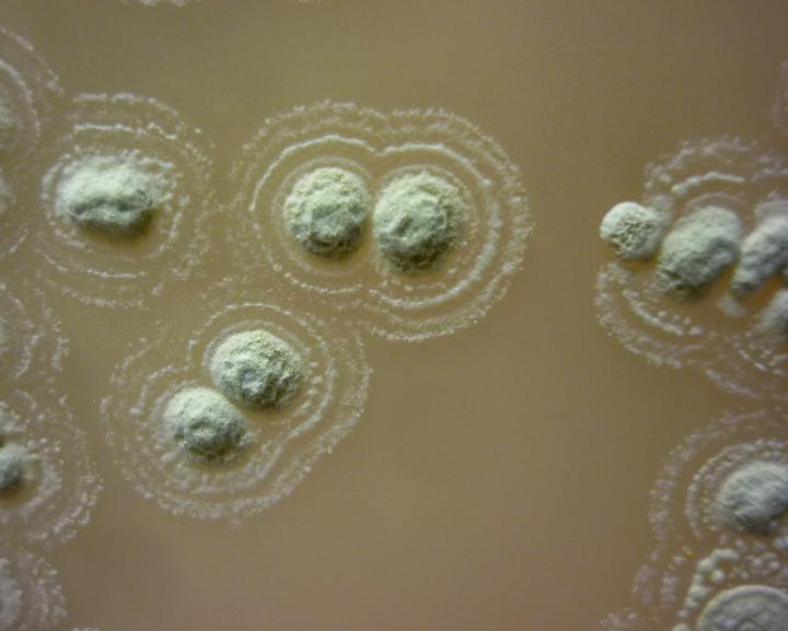 <em>Streptomyces sp. myropherea</em> -- The Newly Discovered Bacteria that Halts Superbug Growth