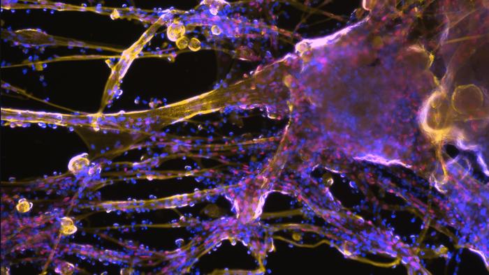 Muscle stem cells and fibers can be grown in the laboratory from reprogrammed connective tissue cells (microscopy image).