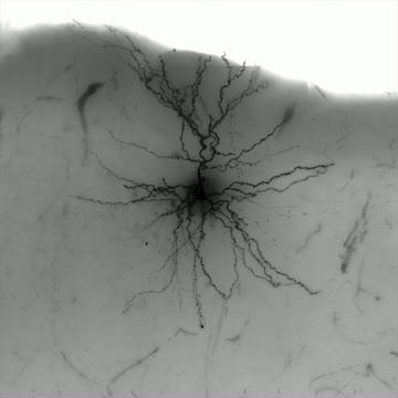 Human Neuron 3-D Reconstruction