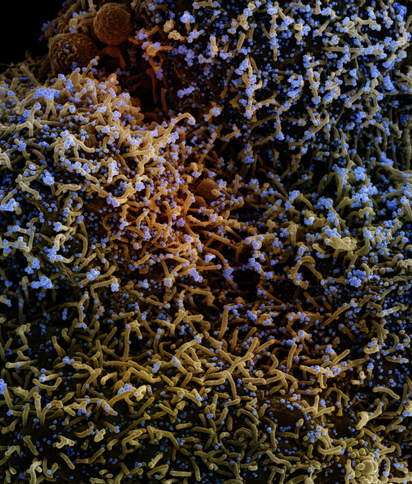 colorized scanning electron micrograph of a cell infected with a variant strain of SARS-CoV-2 virus particles