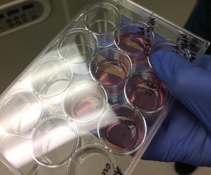 Stem Cells in Culture Alzheimer's Research