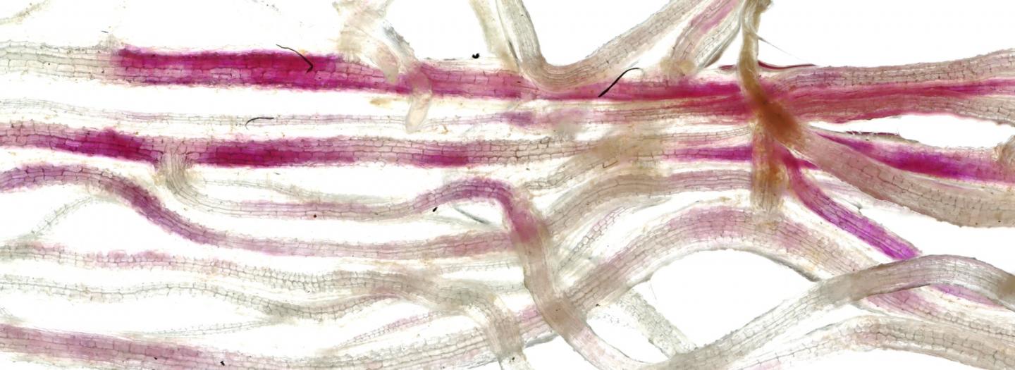 Cells of roots colonised by fungi turn red