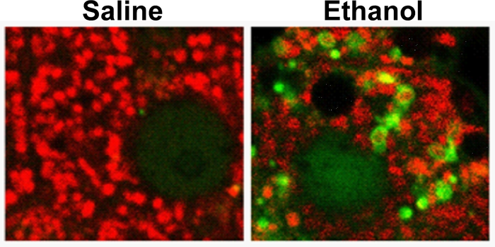 Ethanol treatment activates mitochondrial degradation pathway