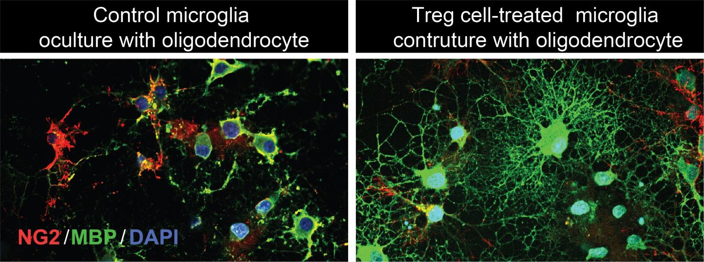 Treg Cells Boost Neuroregeneration