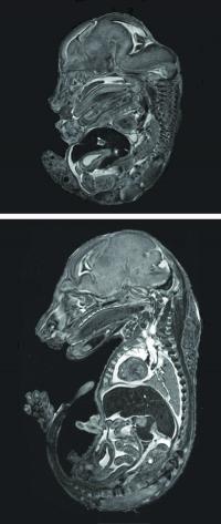 Mouse Fetus MRI