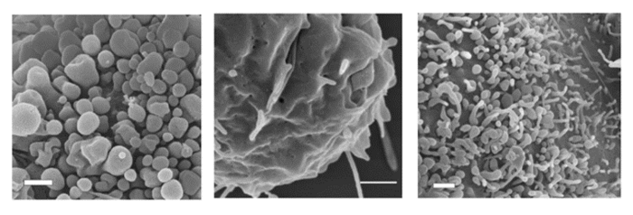 Magnified view of three different types of small surface structures (blebs, ridges, and filopodia-like) on rounded CHO cells.