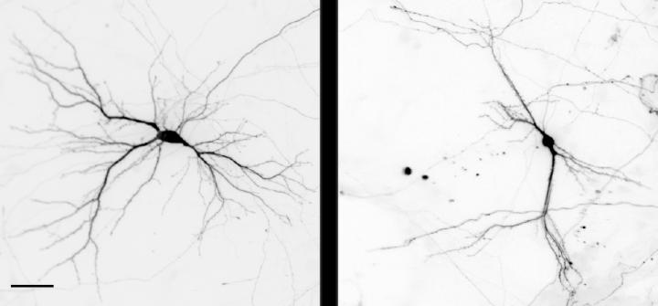 Neurons and Dendrites