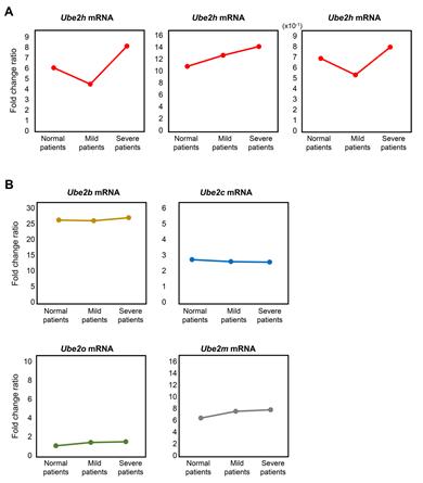 Gene Expression Profile of Ube2 Subfamilies from AD Patients in Blood