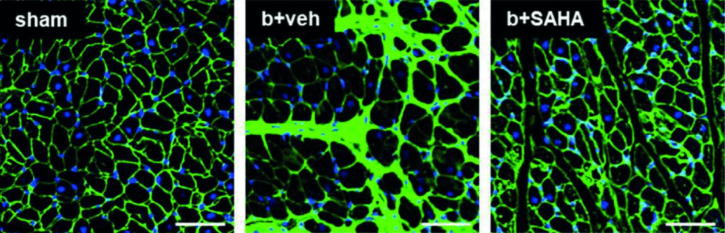 Small Molecule Inhibitor Improves Cat Heart and Lung Function (2 of 3)