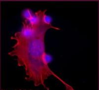 Macrophage (Red Staining) Engulfing Dead Cells (Blue Spots)