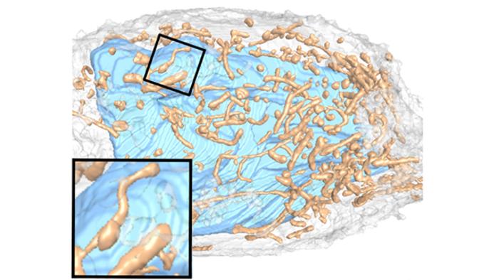 The progression of infection leads to thinner and rougher mitochondria