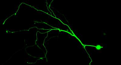 New Molecule Could Save Brain Cells from Neurodegeneration, Stroke