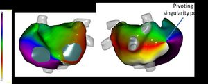 Example of a cardiac map during atrial fibrillation.