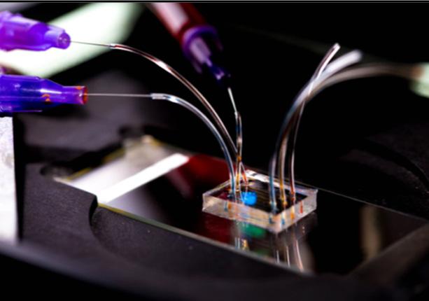 Neutrophil Motility Reveals Potential Sepsis Biomarker