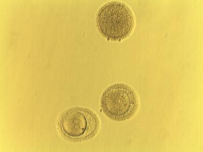 Preserving Human Eggs