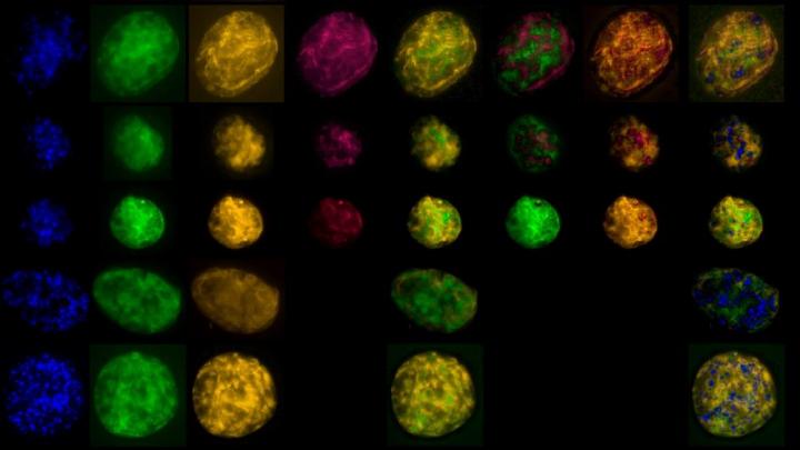 Images of fluorescent in-situ hybridisation of dyed Achromatium oxaliferum.