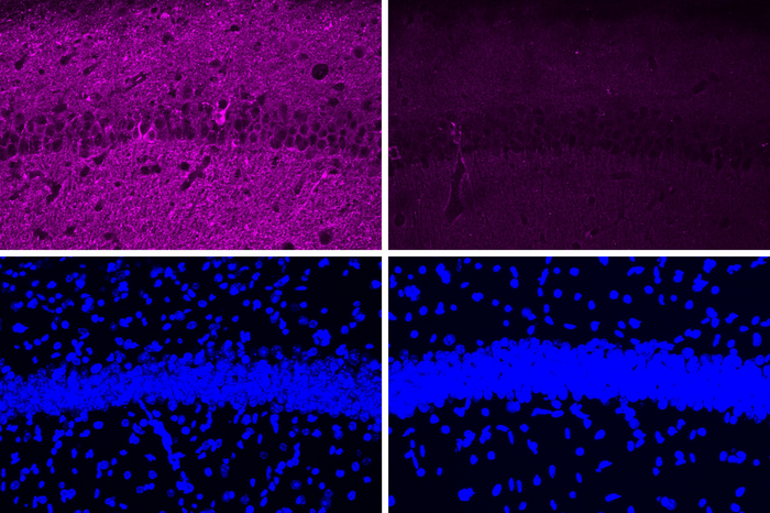 New peptide may hold potential as an Alzheimer’s treatment