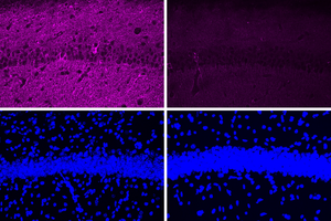 New peptide may hold potential as an Alzheimer’s treatment