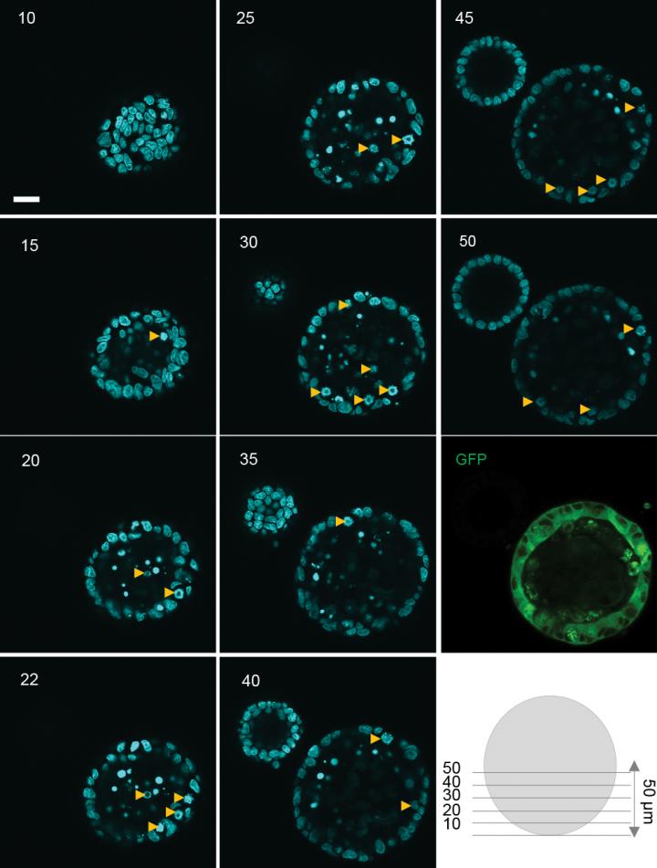 A Master Switch that Lets Cells Know Which Way is Up (1 of 3)