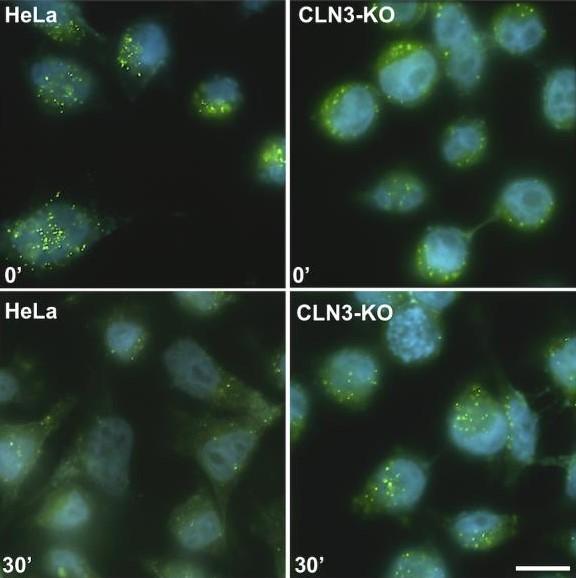 CLN3 protein