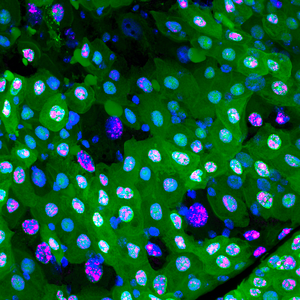 Gut cells at different stages of erebosis