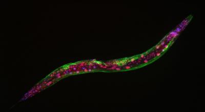 C. elegans Roundworm Imaged with Fluorescent Markers
