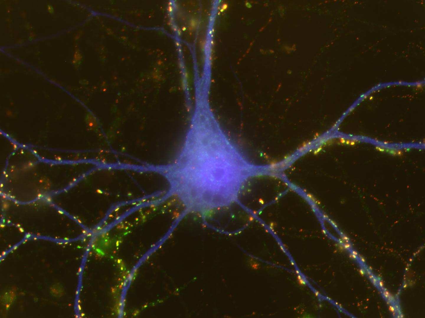 Cortical Neuron Making Connections