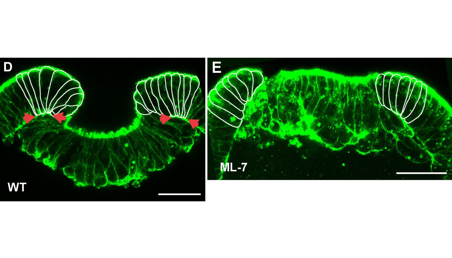 2 The Embryos Treated with the Myosin Inhibitor ML-7