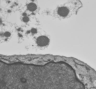 Brain Diseases' Spread Linked to Receptor