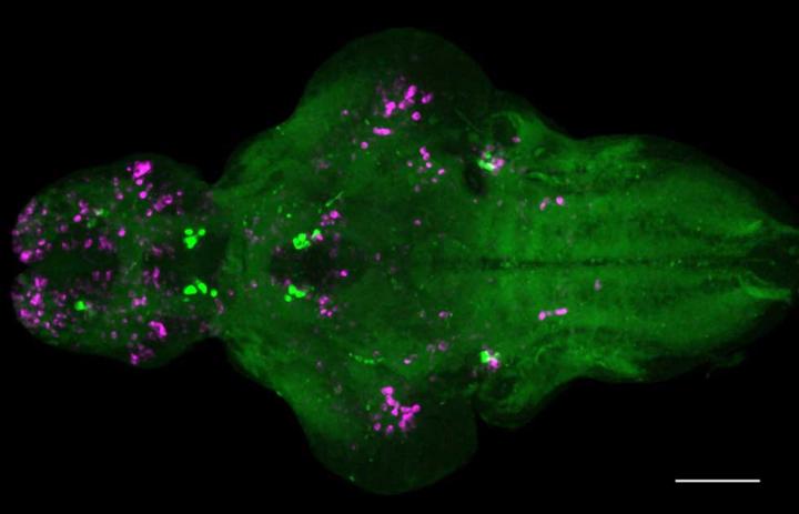 Zebrafish Brain in Response to Nmu Overexpression