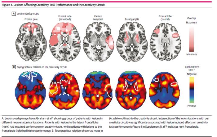 Lesions Affecting Creativity Task Performance and the Creativity Circuit