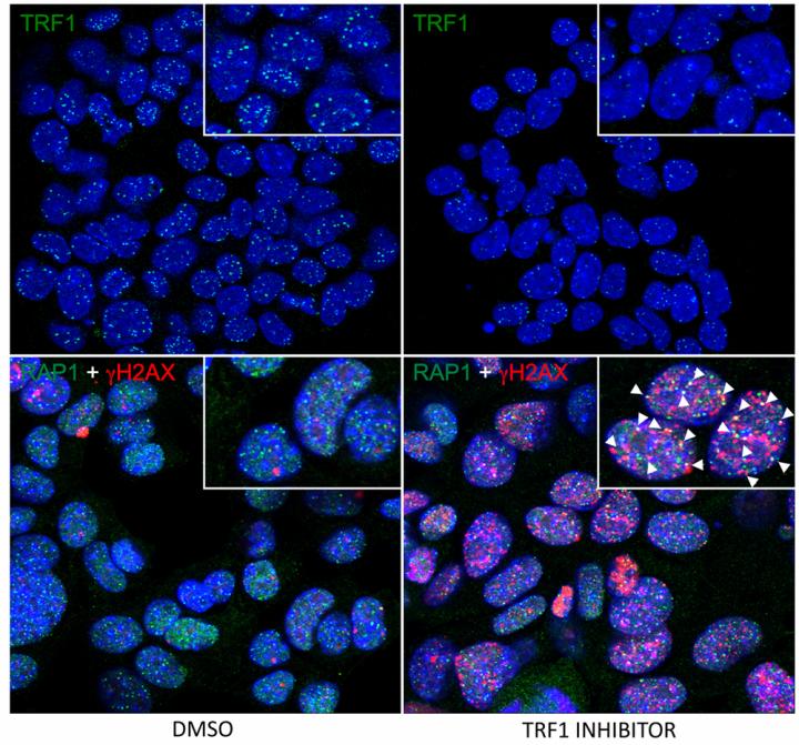 Lung Cancer Cells -- CNIO