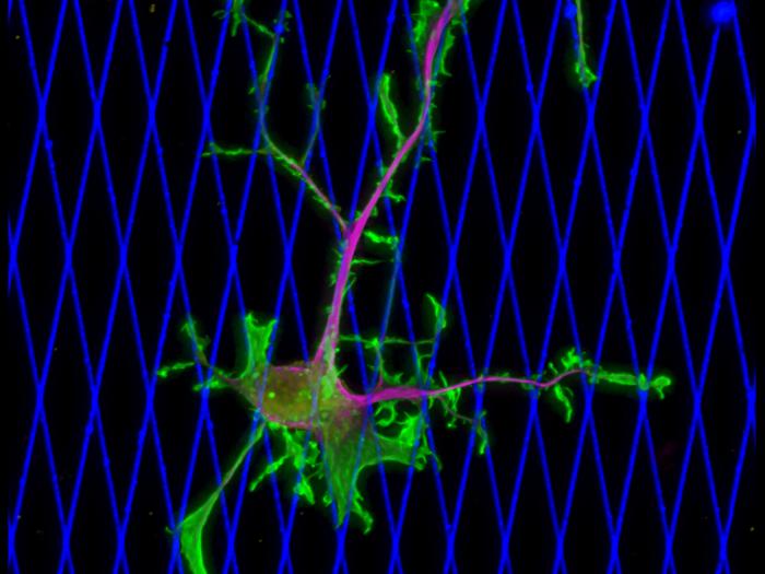 A human breast cancer cell