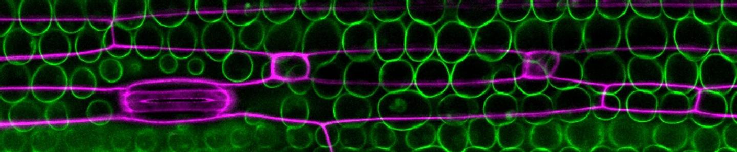 Wheat Leaf Cells