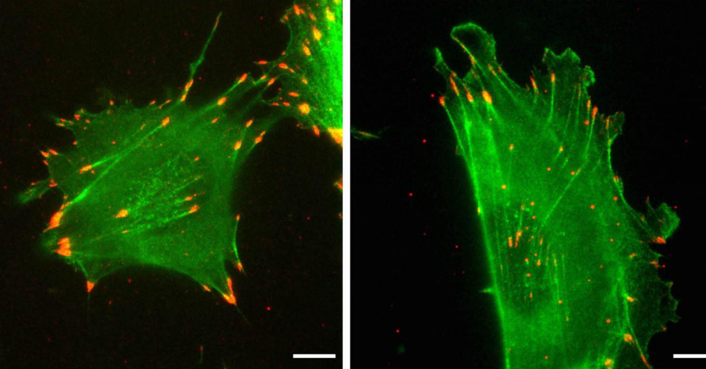 Actin function governed by nucleotide sequence, not amino acid sequence