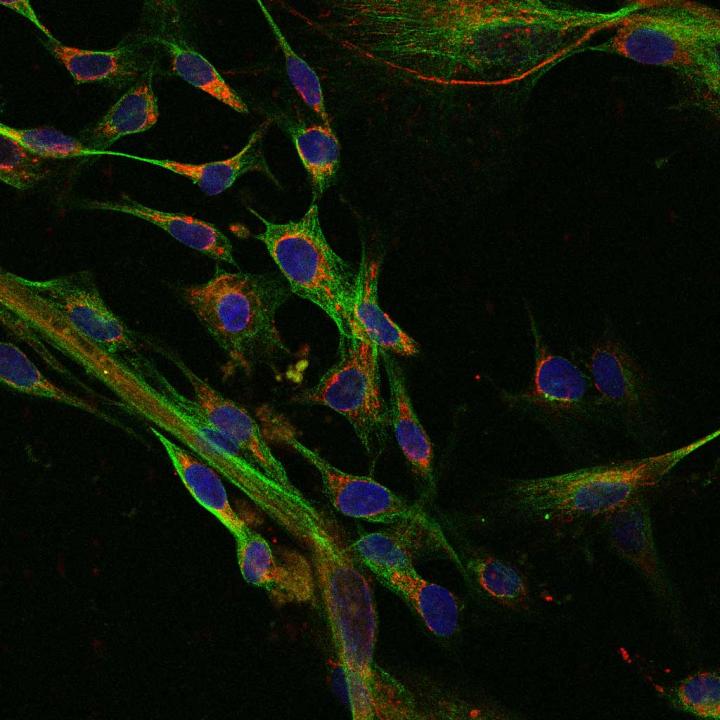 Human Fibroblasts from Embryonic Stem Cells