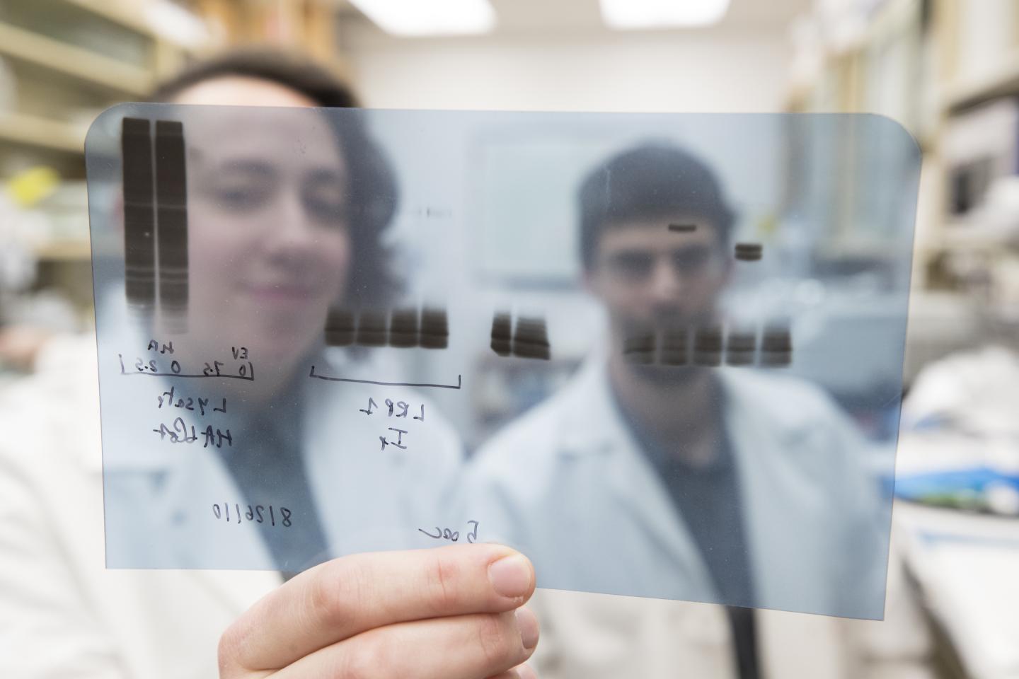 Antidepressant Could Stop Deadly Sepsis, Study Suggests