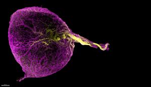 The developing human yolk sac