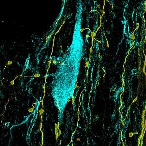 Parvalbumin expressing axons from the HDB contact a cholinergic neuron